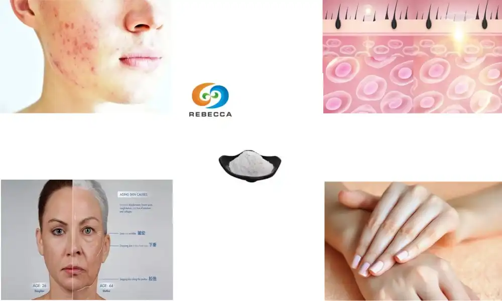 Pterostilbene Powder: Improve Skin Health Naturally